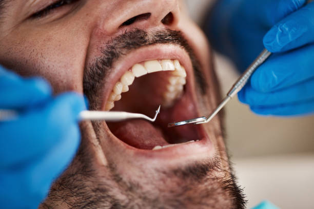 Best Same-Day Emergency Dentist in Clay City, KY
